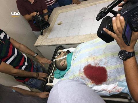 استشهاد فلسطيني متأثرا بإصابته خلال مواجهات أبو ديس 