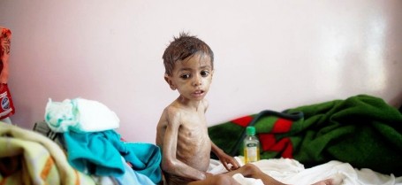 اليمن .. خطر المجاعة يهدد نصف مليون طفل و 2 مليون خارج التعليم