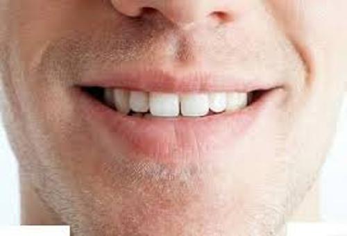 الليمون والحامض لتبييض الأسنان الصفراء