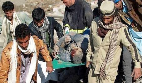 الامم المتحدة: إرتفاع حصيلة الضحايا المدنيين في اليمن إلى 1916 قتيلاً و4186 جريحا   