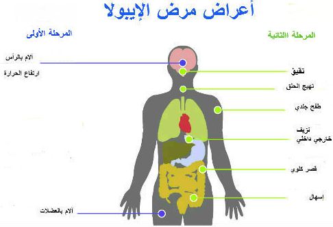 الصحة العالمية تبحث فرض قيود على السفر لاحتواء 