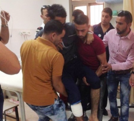 إصابة 3 شبان بالرصاص الحي في بلدة تقوع