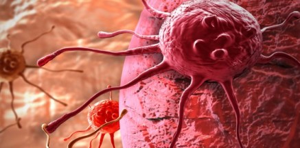 اكتشاف فيروس يقضي على السرطان