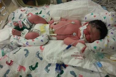 ولادة طفلة طبيعية من أم صدمتها شاحنة