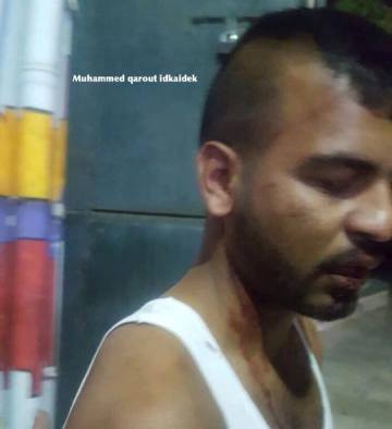 قوات الاحتلال تعتقل فلسطينيا بعد الاعتداء عليه في باب حطة بالقدس