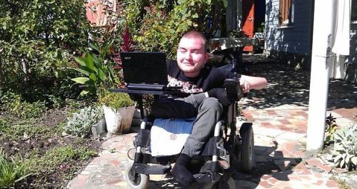 لأوّل مرة.. عملية جراحية لزرع رأس على جسد جديد