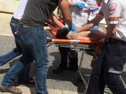 ناشطون يناشدون لمساعدة الطفل قصي أبو ناب ومعالجته