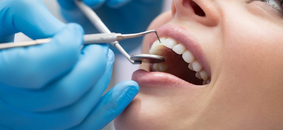 dental-procedures-min-925x425.jpg