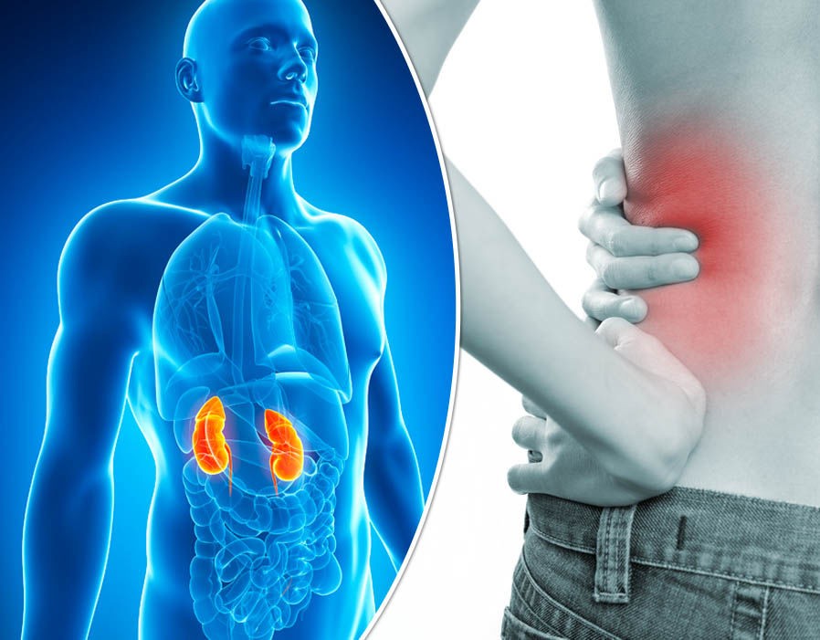 97078-حصوات-الكلى-2.jpg