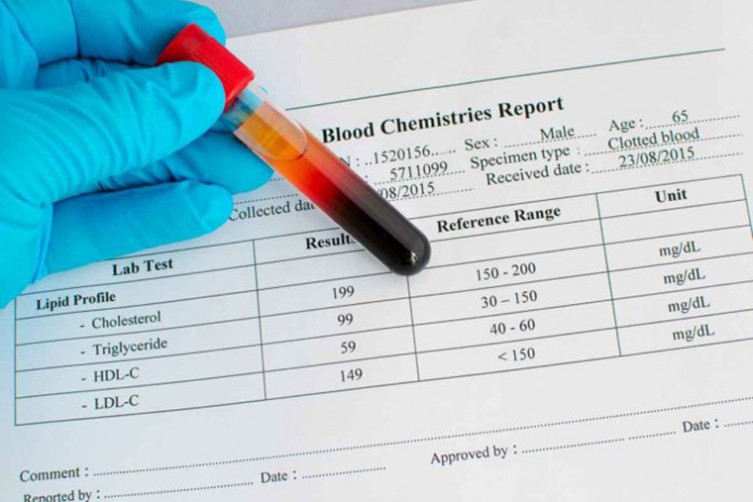 753-5020cholesterol-700x467.jpg