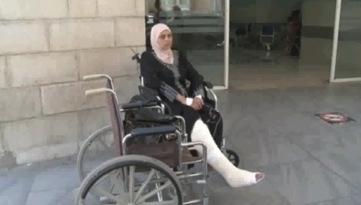 المواطنة زيادة تخضع للعلاج بعد إصابتها باعتداء للاحتلال برام الله