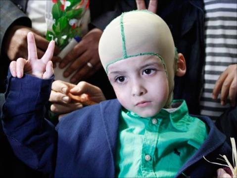 أبو فاعور يجدد استعداد وزارة الصحة لمعالجة الطفل دوابشة