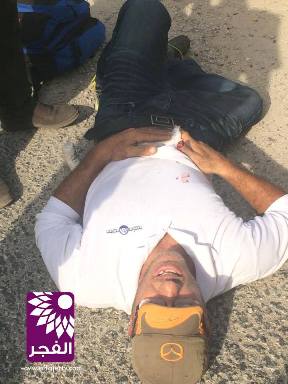 إصابة شاب فلسطيني برصاص مستوطن قرب طولكرم