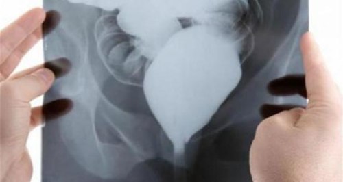 أمريكية أزالت نصف معدتها بسبب تشخيص خاطئ