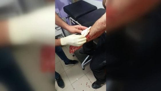 إصابات جراء إلقاء قنبلة في عين الحلوة