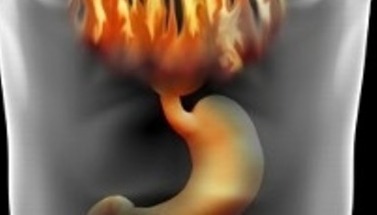 نار تندلع في معدة مريض أثناء عملية جراحية 