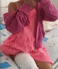 هاتف سامسونغ ينفجر في بنطال طفلة ويصيبها بحروق 