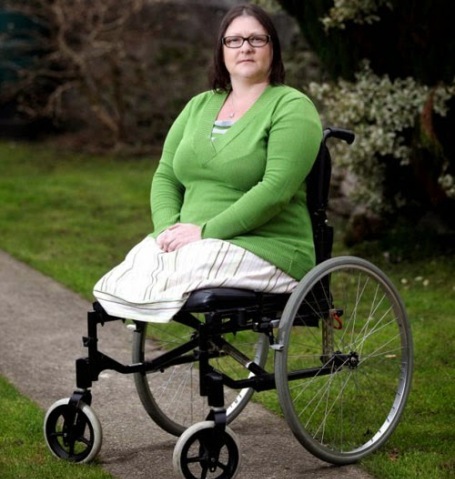 بعد أن فقدت قدميها..بريطانية تطلب بنشر صورتها على علب السجائر كتحذير صحي 