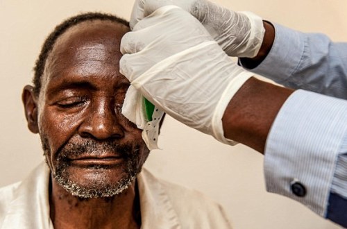 جراحة استغرقت 6 دقائق فقط أعادت لرجل بصره