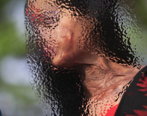 شاب يحرق وجه مراهقة لأنها ألغت طلب صداقته