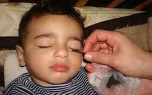 أضرار الكحل على عيون الاطفال