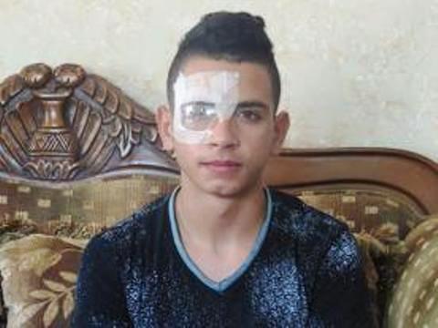 عيون الأطفال الفلسطينيين في مرمى رصاص الاحتلال