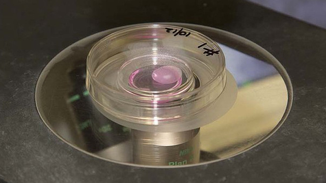 تقنية جديدة لحفظ الأعضاء البشرية عدة أيام قبل إعادة زرعها