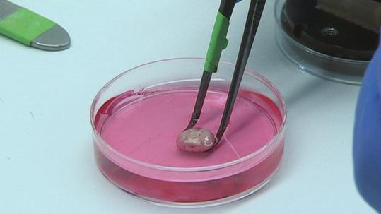 تحرك هائل في توظيف علم التخلق لعلاج السرطان