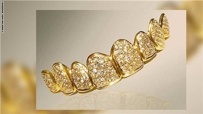 أغلى ابتسامة في العالم بدبي