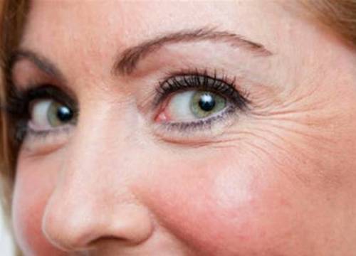 طريقة لإخفاء التجاعيد حول العينين