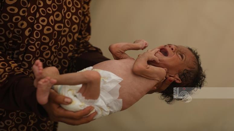 مجاعة اليوم.jpg-171d31b5-0309-41d5-b17e-68d12b1952de.jpg