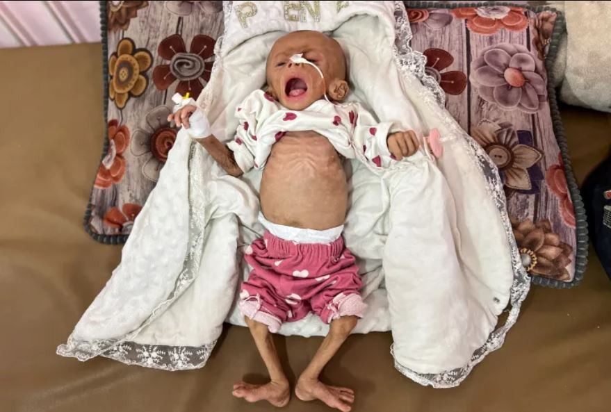 وفاة رضيع.jpeg